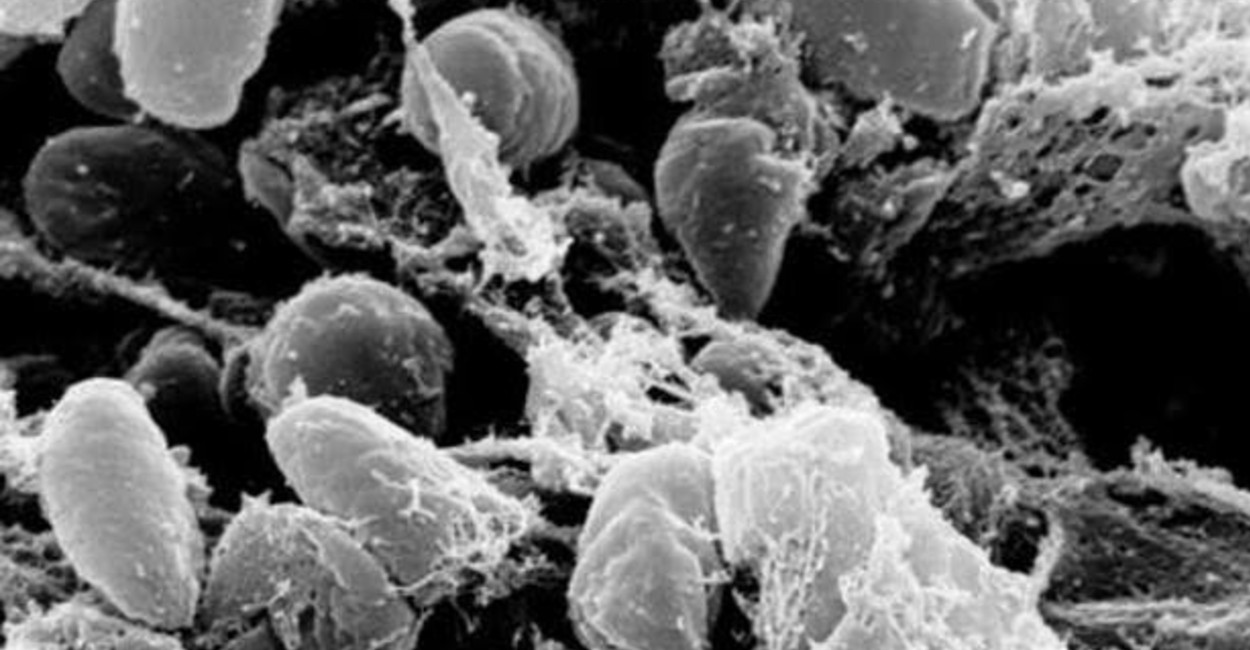 La peste está causada por la bacteria Yersinia pestis.