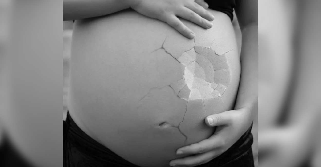 Entre su esposo y ella, atacaron a la mujer embarazada. | Foto: Cortesía.