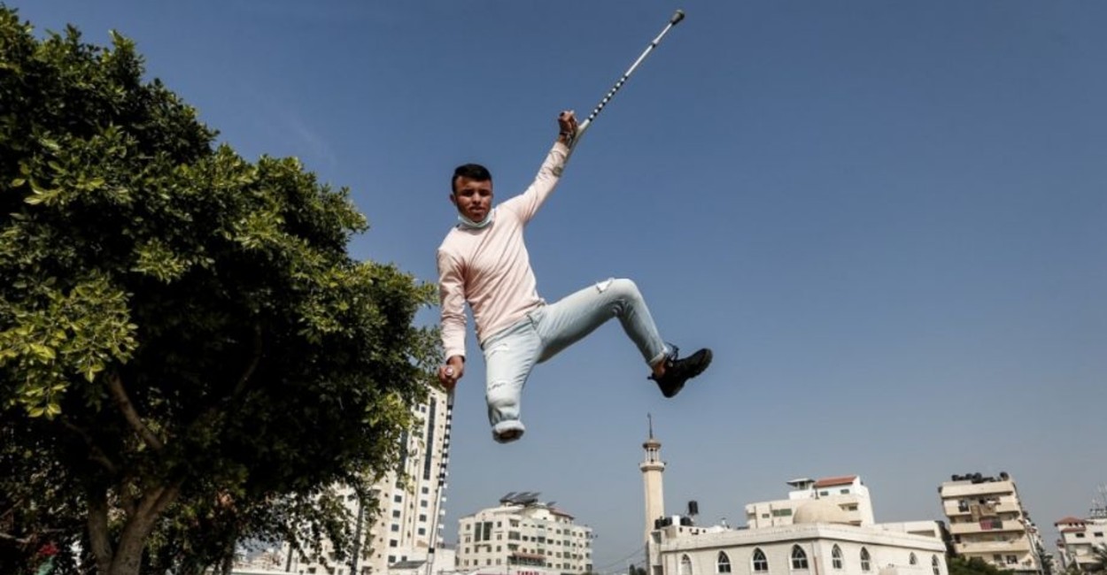 A este palestino de 18 años le amputaron la pierna tras un recibir un disparo. | Foto: Cortesía.