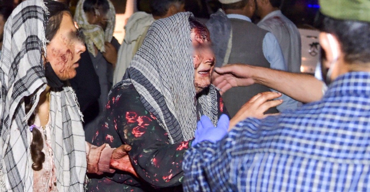Quedaron cientos de heridos, entre ellos mujeres y niños. | Foto: Wakil KOHSAR / AFP.