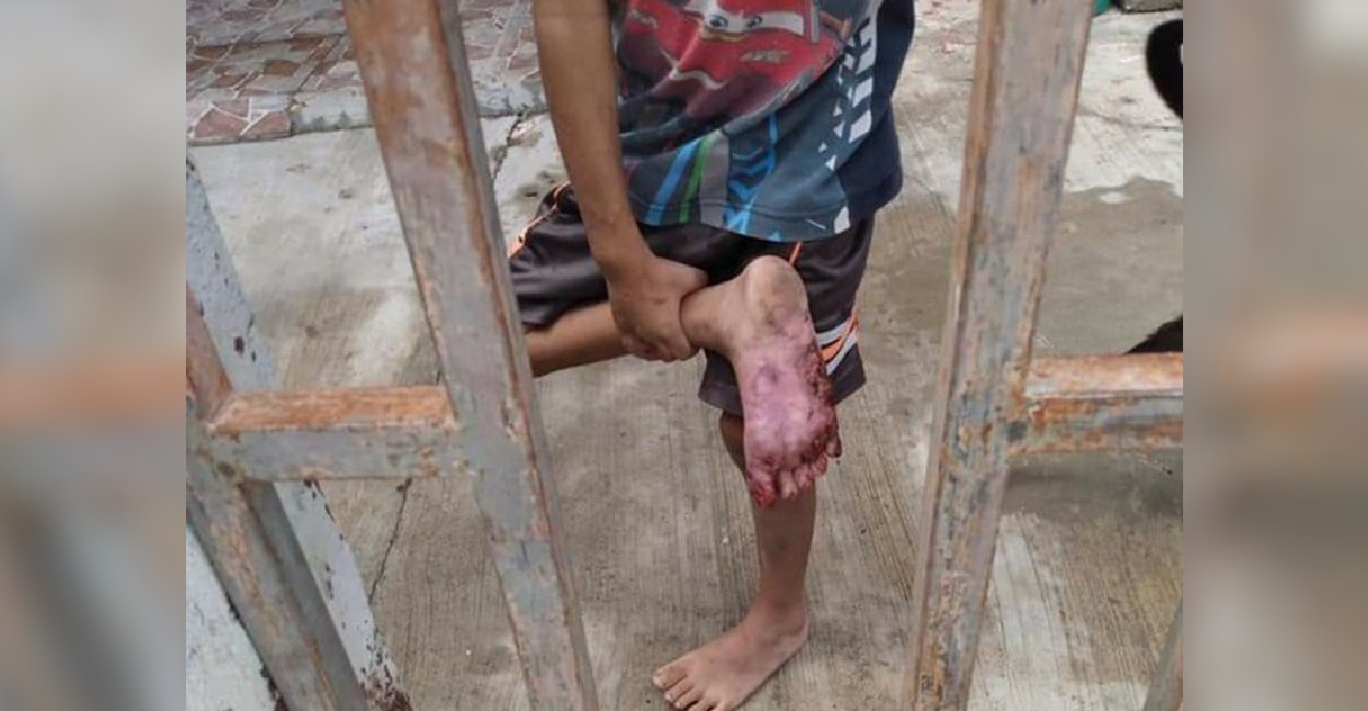 El niño mostró que tenía los pies lastimados. | Foto: Excélsior.