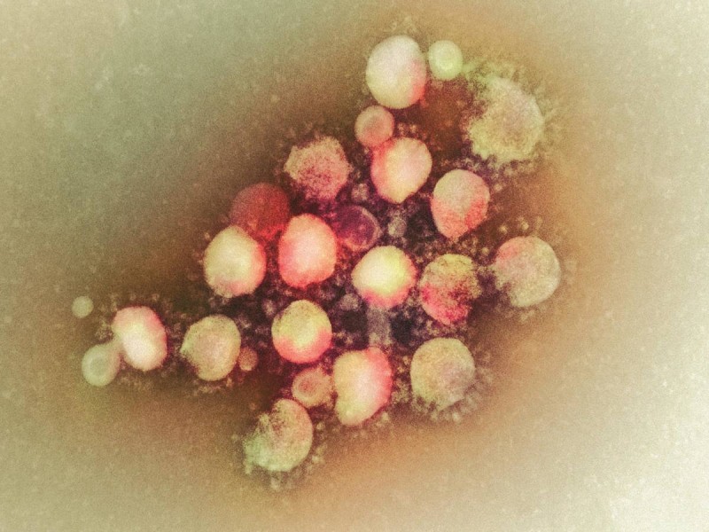 ¿Qué es el coronavirus Mers? La enfermedad que alertó a la OMS