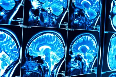 Un nuevo descubrimiento ha sorprendiendo a los científicos y abriendo muchas interrogantes en torno a lo que se conoce respecto al cerebro humano.